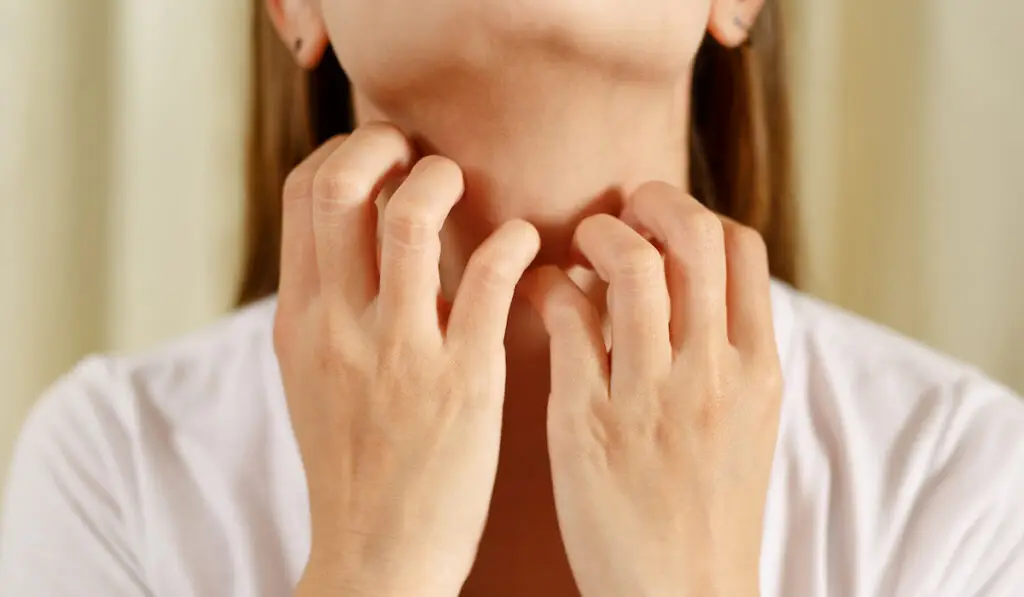 Woman scratching neck