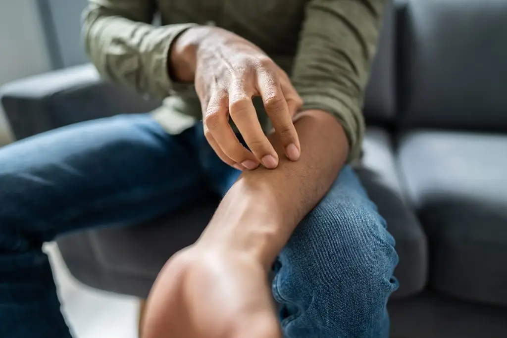 Contact dermatitis - Itchy skin