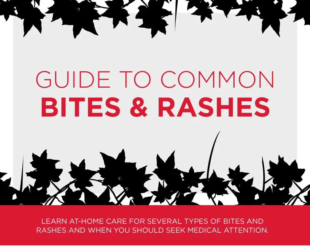 Your Guide to Common Bites and Rashes
