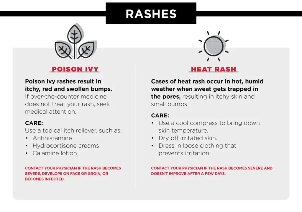 Infographic explains two rashes, poison ivy and heat rash, and also includes at-home care instructions and when to seek care from a physician.