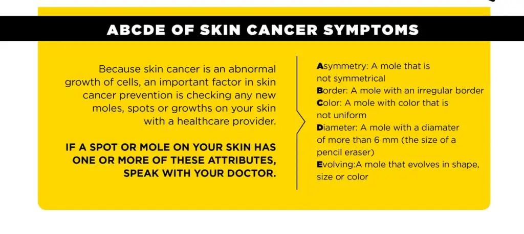 Skin cancer symptoms include moles that have: asymmetry, irregular border, different colors, a diameter of more than 6mm, changed in size or color.