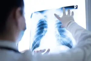 Lung Cancer Symptoms