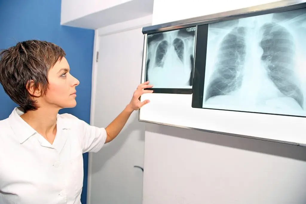 Provider looking at lung x-rays