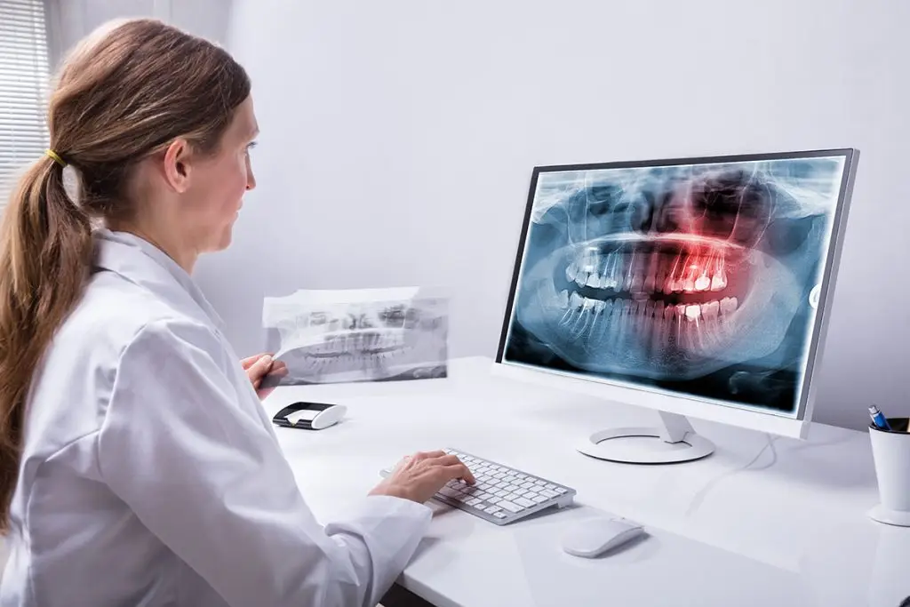 Doctor looking at X-ray of mouth