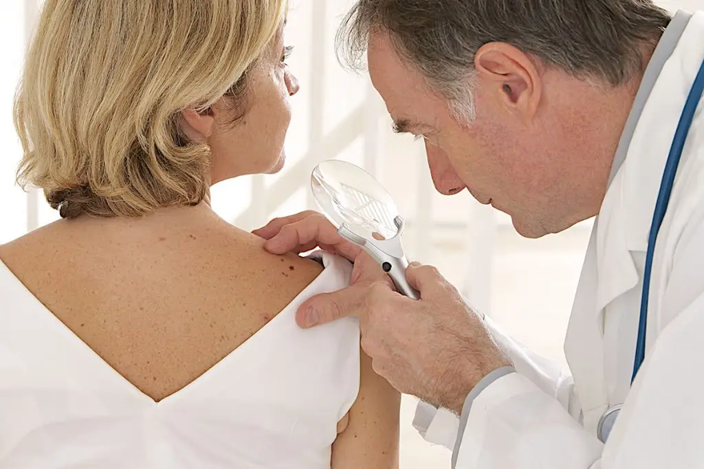 woman being checked for skin cancer