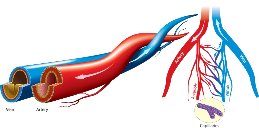 What Is Vascular Disease?