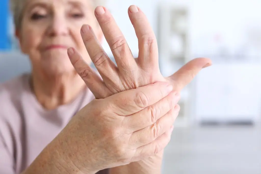 Woman holding hands affected by arthritis